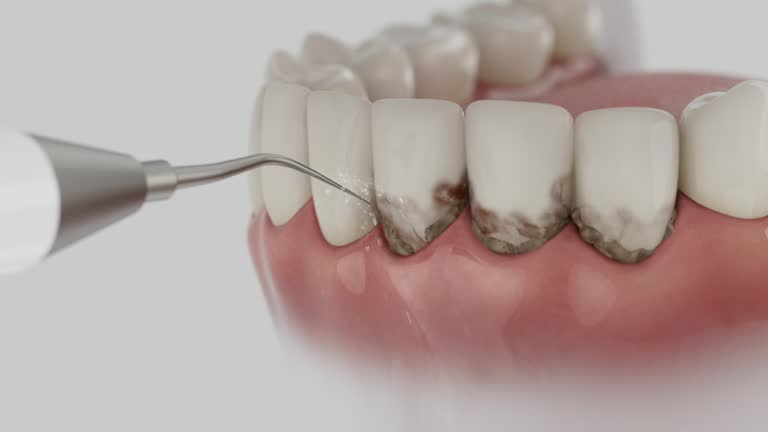 Reliable Teeth Whitening contractor in Emmons County County, ND by Dentist Open Now